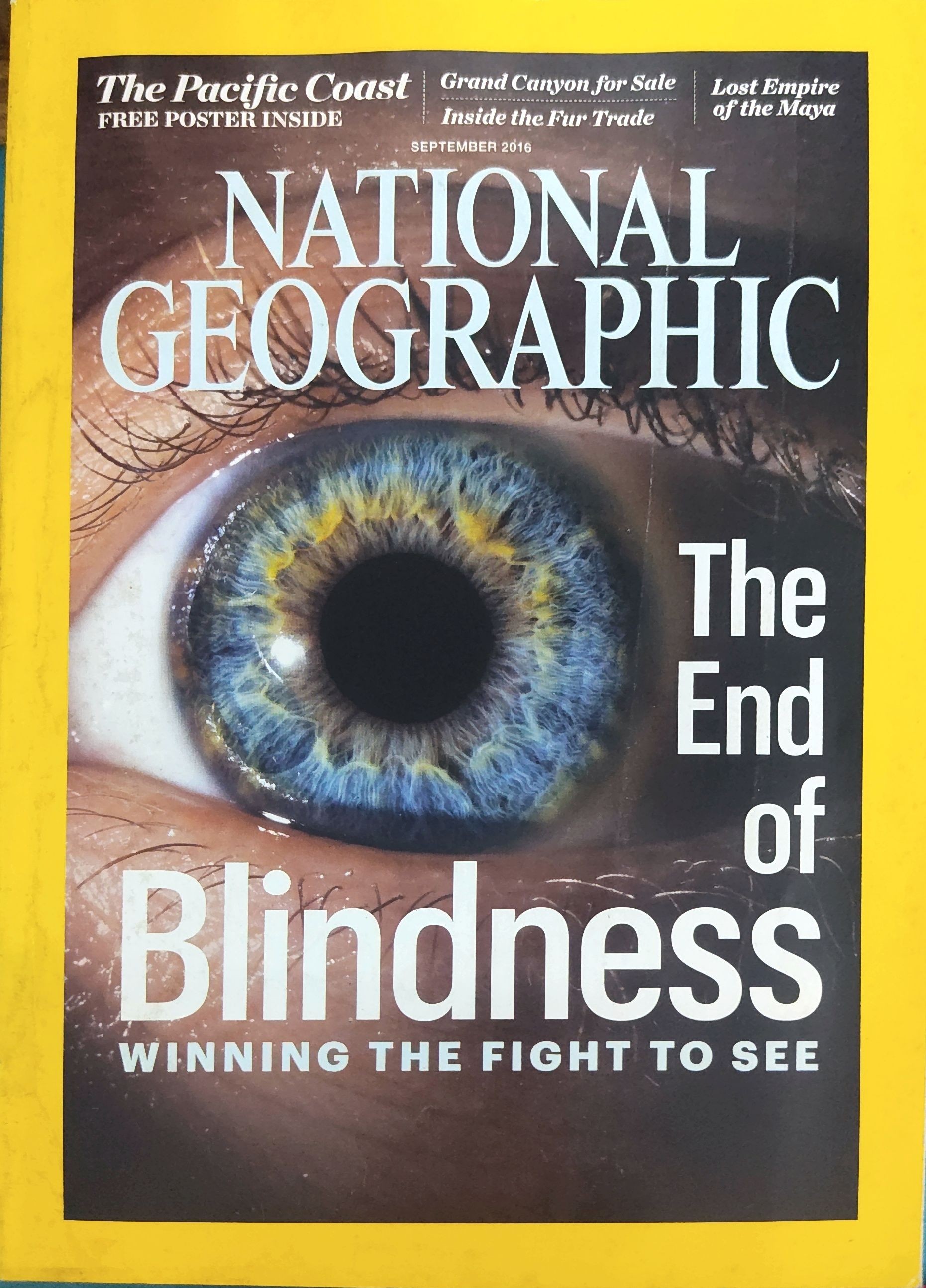 National Geographic - The End of Blindness